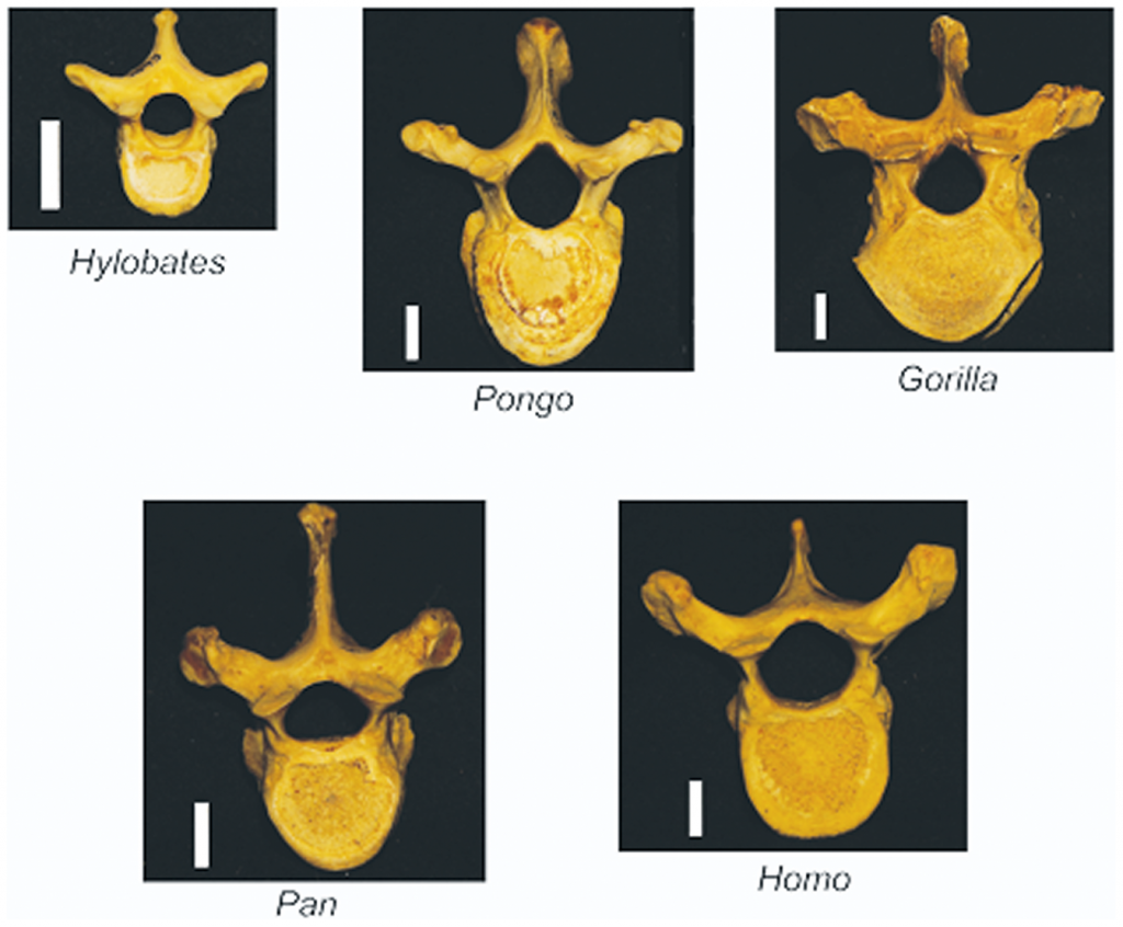 This photo from the research article, "Human Evolution and Osteoporosis-Related Spinal Fractures" shows examples of thoracic vertebrae from five species -- gibbons, orangutans, gorillas, chimpanzees, and humans.
