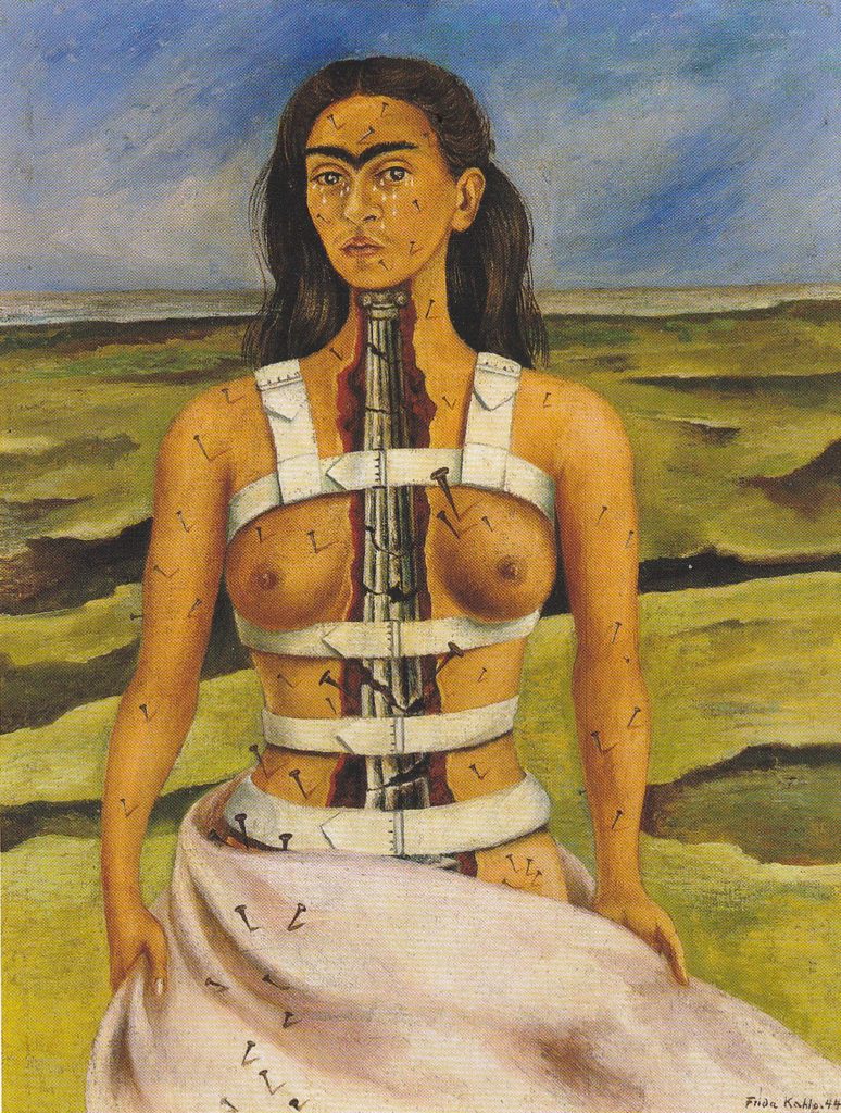 The Broken Column, one of Frida Kahlo's most famous paintings, shows the artist topless except for a medical corset, A line in the middle of her body is peeled away to reveal a crumbling ionic column. Frida's body is covered with nails, and her face in covered with tears. A white sheet swirls around the lower half of her body.