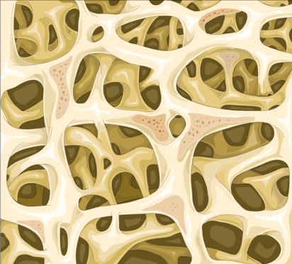 An illustration showing the spongy network of bone inside a vertebrae. The outgrowths of bone make a rough grid, with horizon and vertical lines crossing.